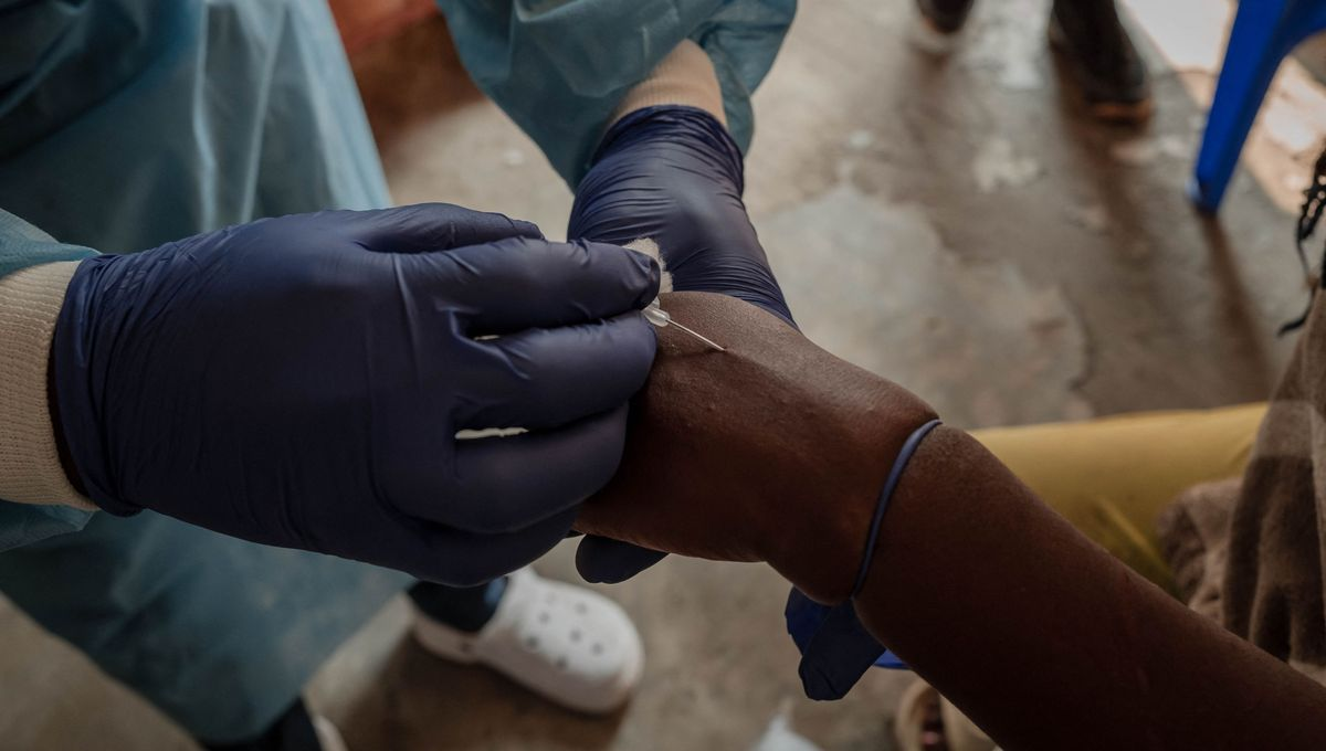 Mpox (Variole du Singe) : Le Sénégal Active son Centre des Opérations d'Urgence Sanitaire