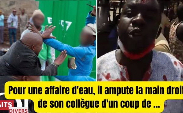 Faits Divers Sénégal: Pour une banale Affaire d'eau, il lui Ampute le Bras